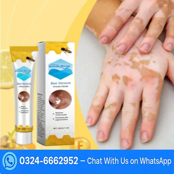 Bee Venom Vitiligo Treatment Cream In Pakistan