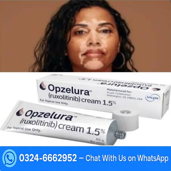 Opzelura Ruxolitinib Cream For Vitiligo In Pakistan