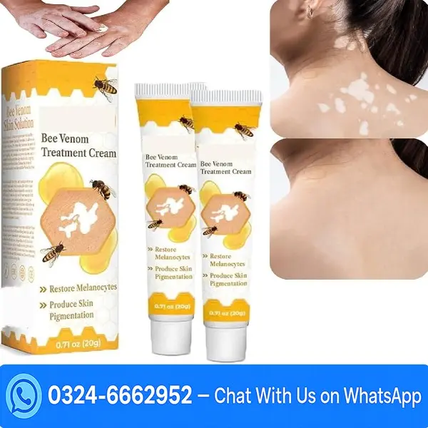 South Moon Bee Venom Vitiligo Cream In Pakistan