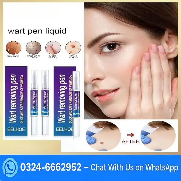 Wart Removing Pen In Pakistan